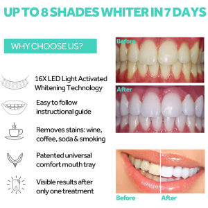 ZL-PRT03 Teeth Whitening Accelerator Light, 16x More Powerful Blue LED Light, Mouth Tray Teeth Whitening Enhancer Light Trays Connected with iPhone/ Micro-USB Android/ USB for Home Use